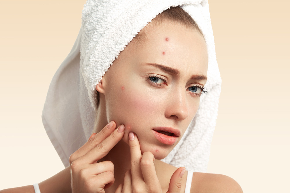 Wajah, Retinol, Tips, Efek Samping, Cara Mengatasi