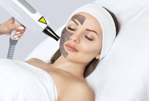 cara menghilangkan blackhead