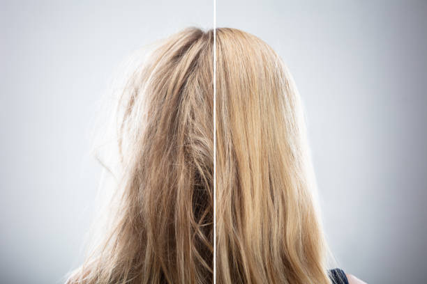 perbedaan smoothing dan rebonding