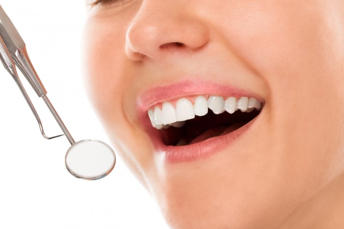 Teeth whitening dapat meningkatkan kesehatan gigi dan mulut kamu