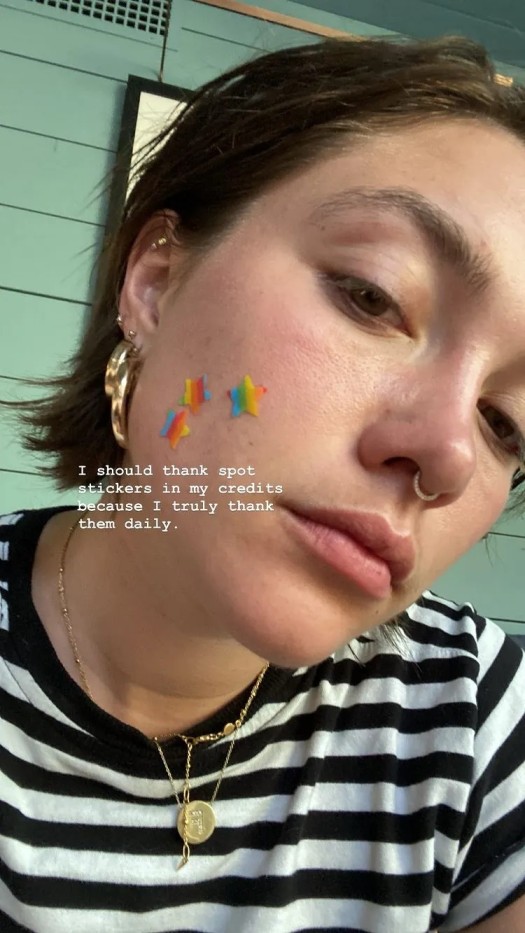 Rahasia Kecantikan Mudah dan Praktis Florence Pugh Mengatasi Jerawat
