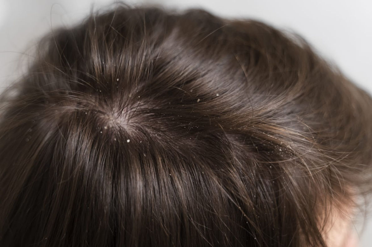 Mengenal Hot Oil dan manfaatnya untuk rambut