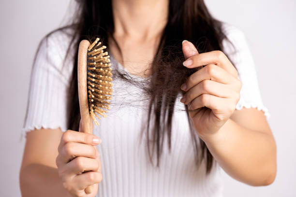 Penyebab Kerontokan Rambut
