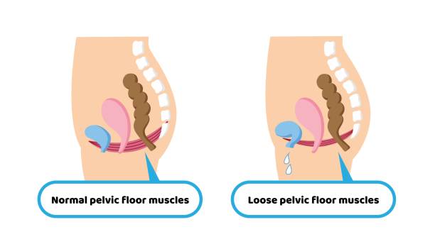 Senam Kegel Sederhana Untuk Merapatkan Miss V
