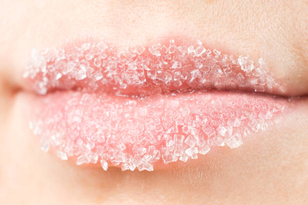 Membuat Bibir Hitam Menjadi Merah