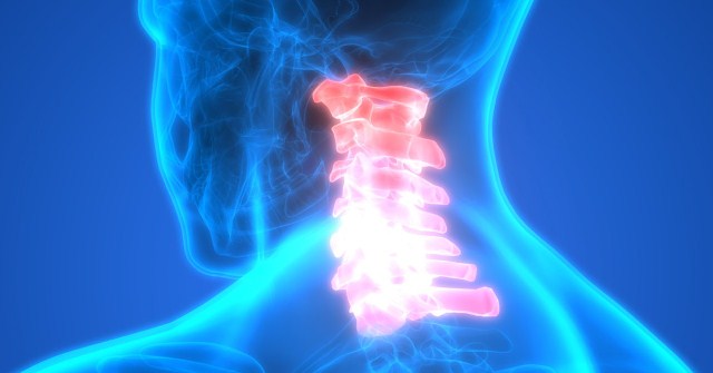 cara mengobati sakit leher belakang secara alami 