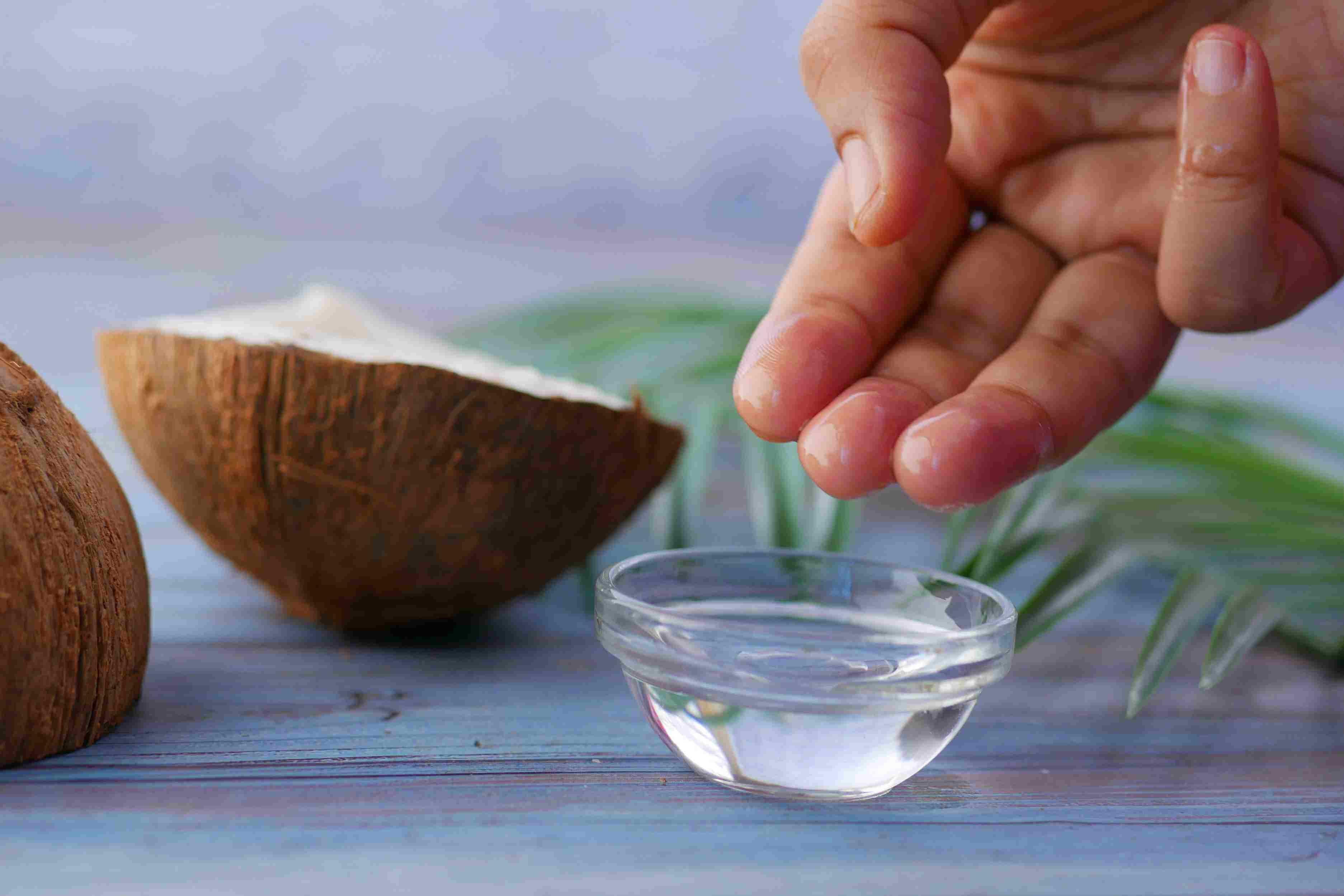 Ketombe. Cara hilangkan ketombe. Solusi rambut ketombean. Minyak kelapa.