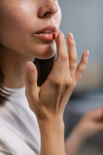 cara atasi bibir kering saat musim hujan, atasi bibir kering, cara atasi bibir kering, musim hujan