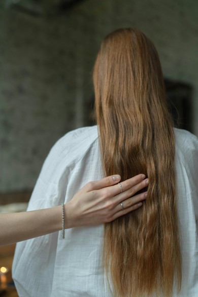 solusi hilangkan ketombe di rambut, ketombe rambut, cara merawat rambut, ketombe