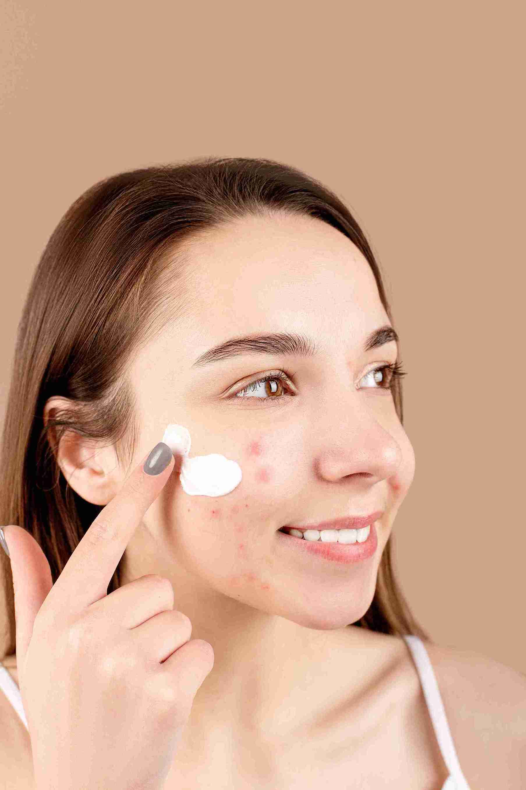 (Basic skincare untuk kulit berjerawat-menggunakan obat jerawat. Foto: Dok. Anna Nekrashevich/Pexels)