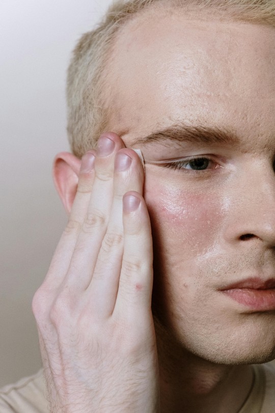 akibat kulit menjadi kering bersisik, kulit bersisik, kulit kering, dry skin, kering