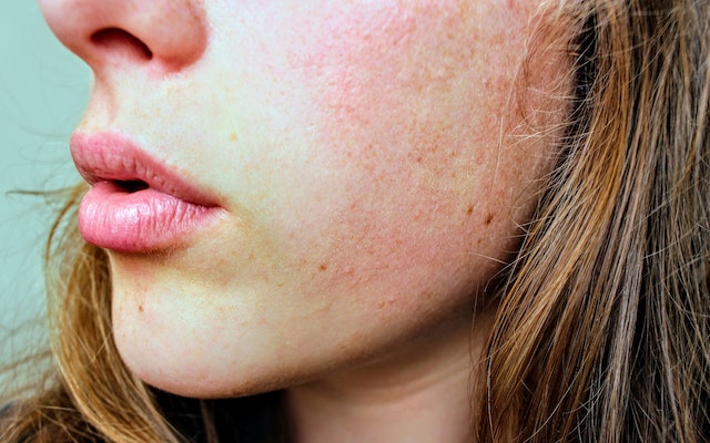 tanda skincare tidak cocok pada kulit, tanda kulit tidak cocok skincare