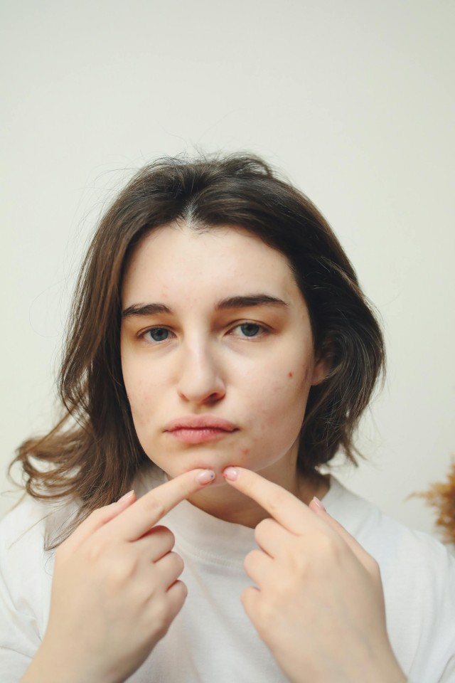 efek niacinamide pada kulit wajah, niacinamide, serum, kulit lembap, skin barrier