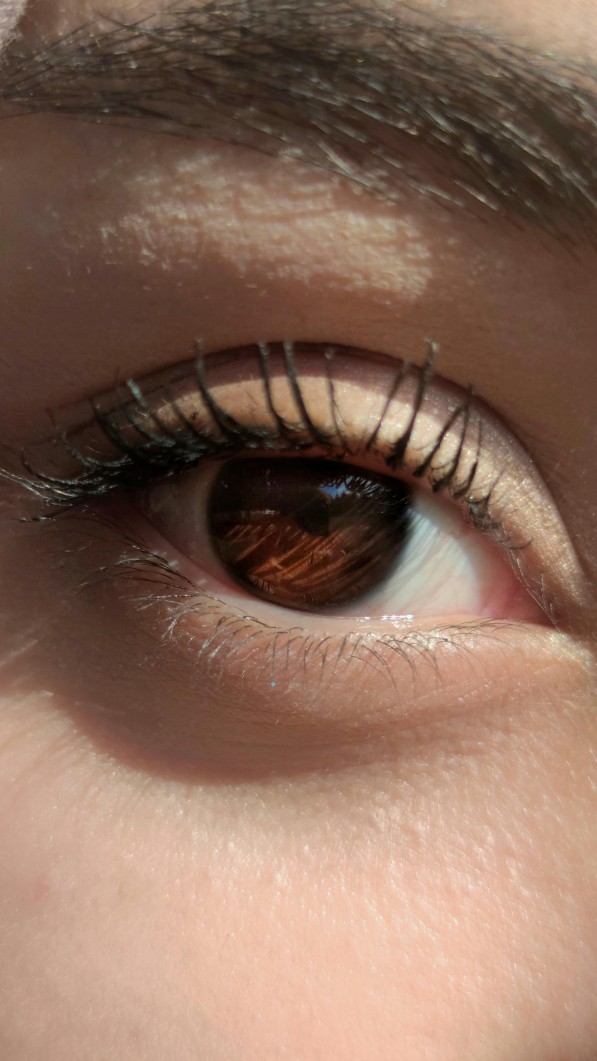 dampak tidur menggunakan contacts lens, contact lens, akibat mata pakai contacts lens, mata merah, tidur menggunakan contact lens