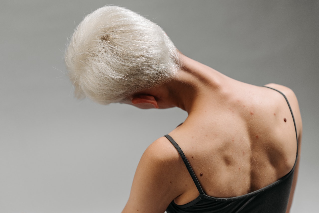 cara mengobati sakit leher belakang secara alami 