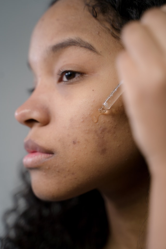 urutan pemakaian skincare yang benar, serum dulu atau cream dulu