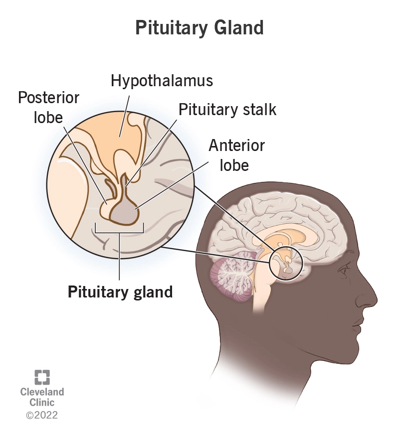 Empty Sella Syndrome