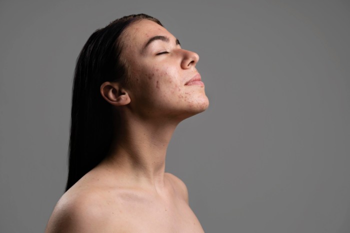 Retinol dapat meregenerasi kulit sehingga bantu melembutkan kulit yang bertekstur