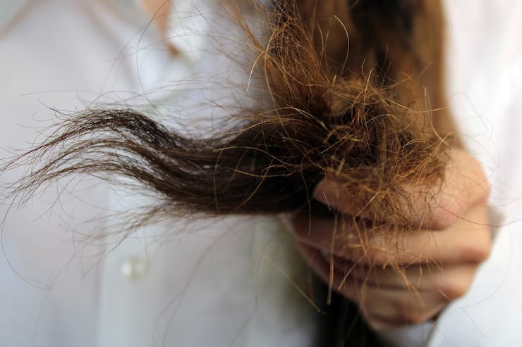 Manfaat Aloe Vera Untuk Rambut Rusak