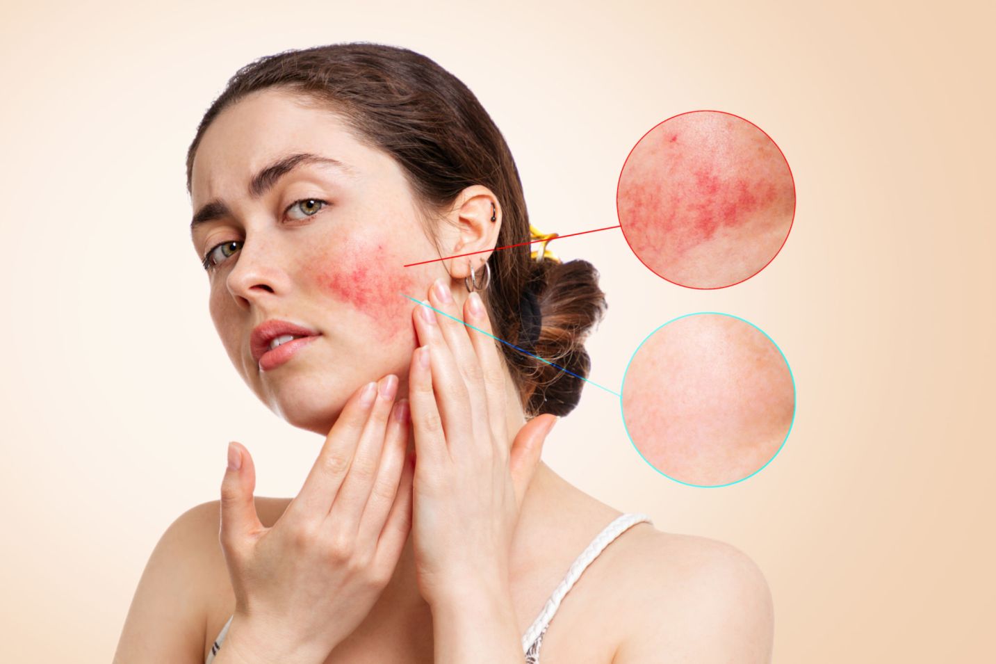 tanda kulit tidak cocok dengan skincare