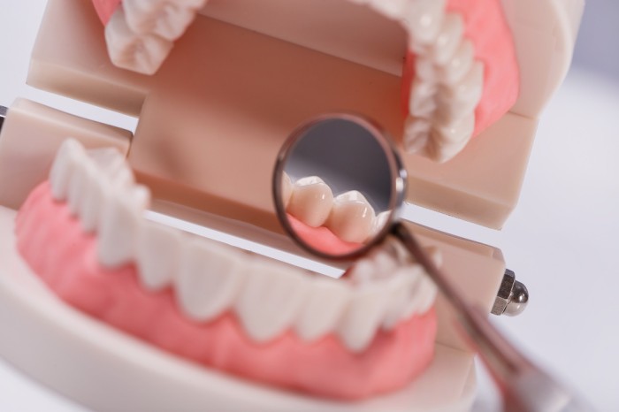 Teeth whitening dapat bantu membunuh banteri sebabkan sakit gigi.