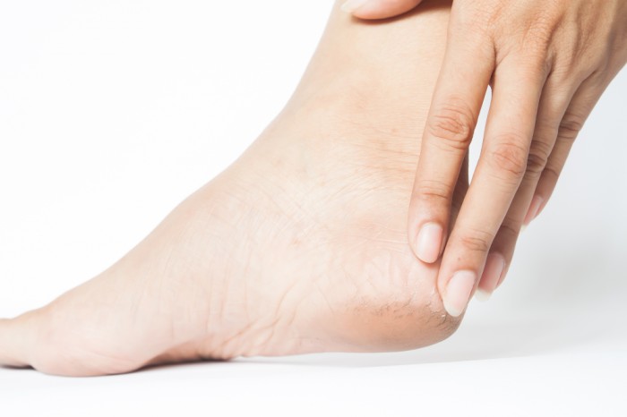 Baby oil bantu melembutkan kulit kering ada tumit dan siku