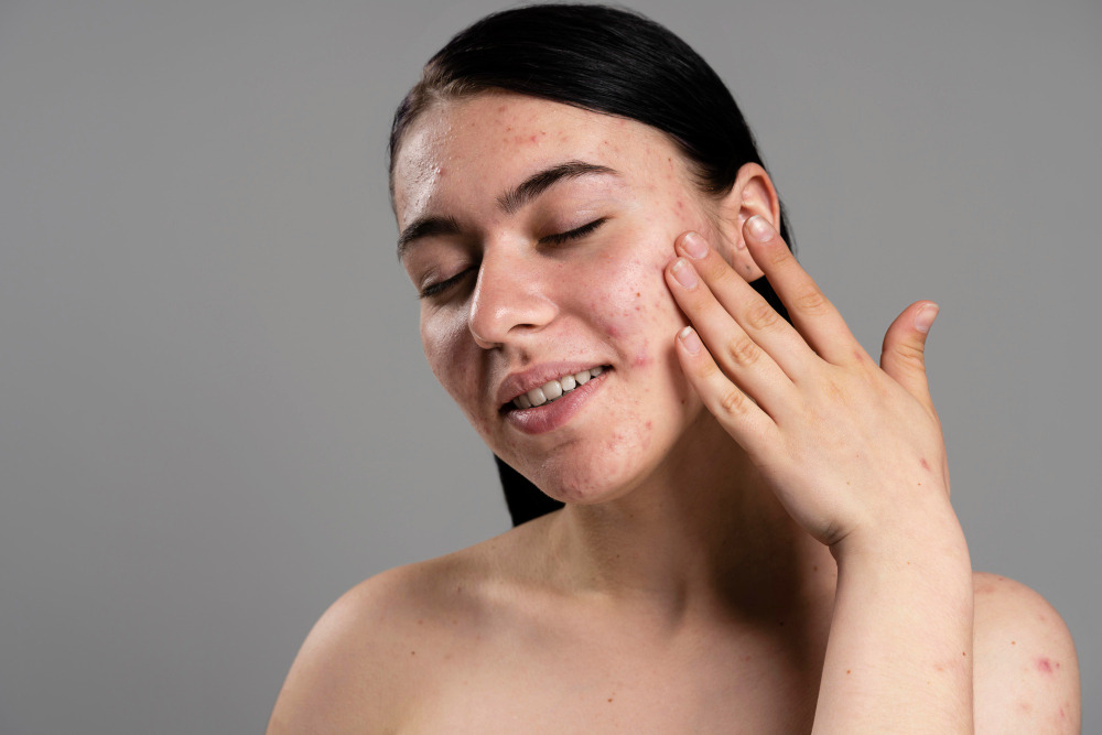Ini Dia 5 Efek Samping Retinol dan Cara Mudah Mengatasinya!