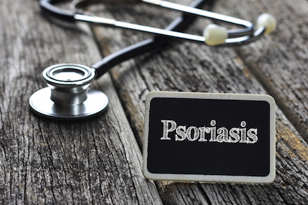 Mengenal Psoriasis dan Perawatannya