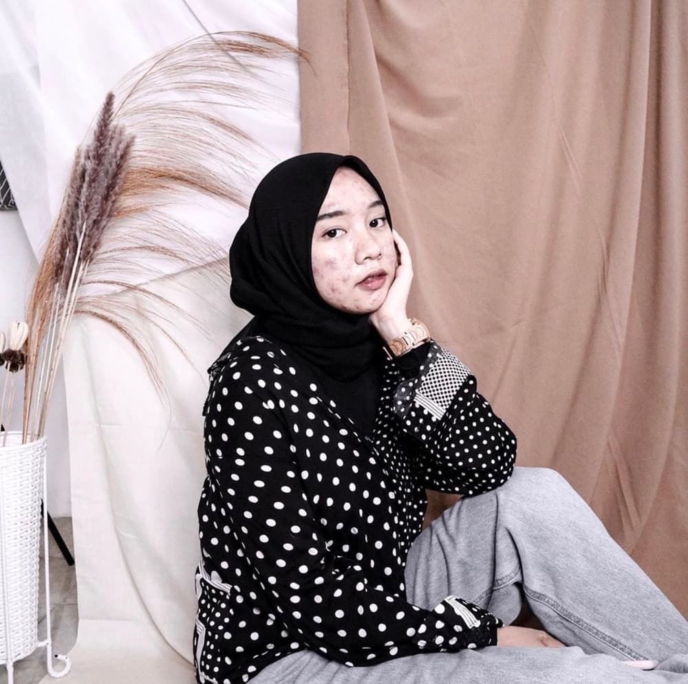 Pede Berjerawat, Novia Nur Ismi Jadi Beauty Influencer Viral