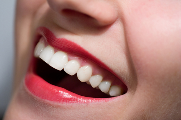 Perawatan Gigi Putih untuk Senyum yang Memikat