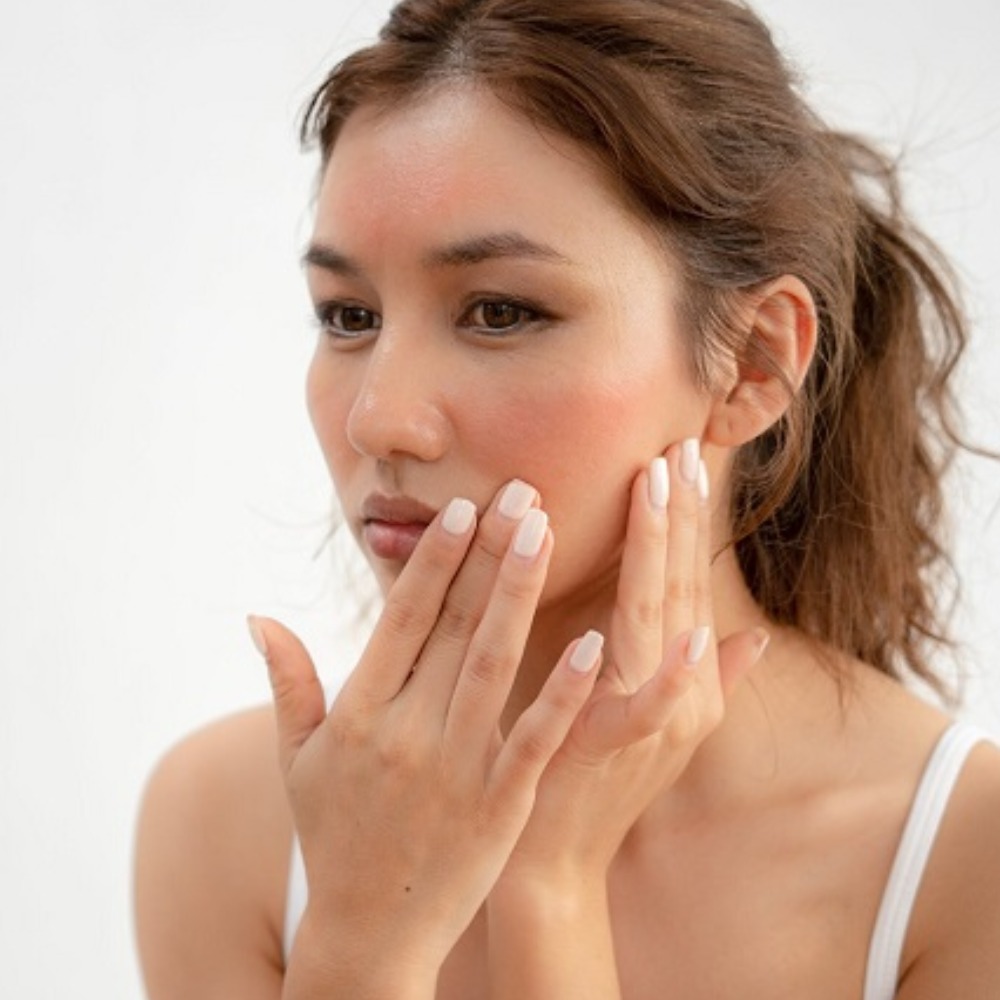 Hati-hati, Ini Tips Merawat Kulit Wajah yang Sensitif