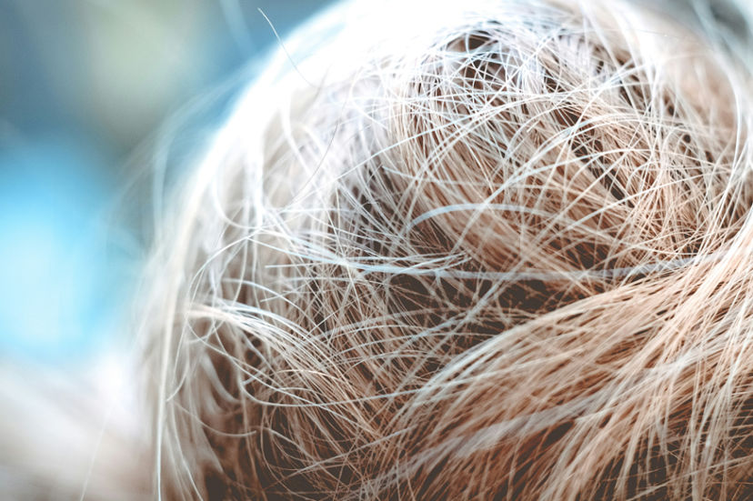  5 Minyak Esensial Untuk Memperbaiki Rambut Kering