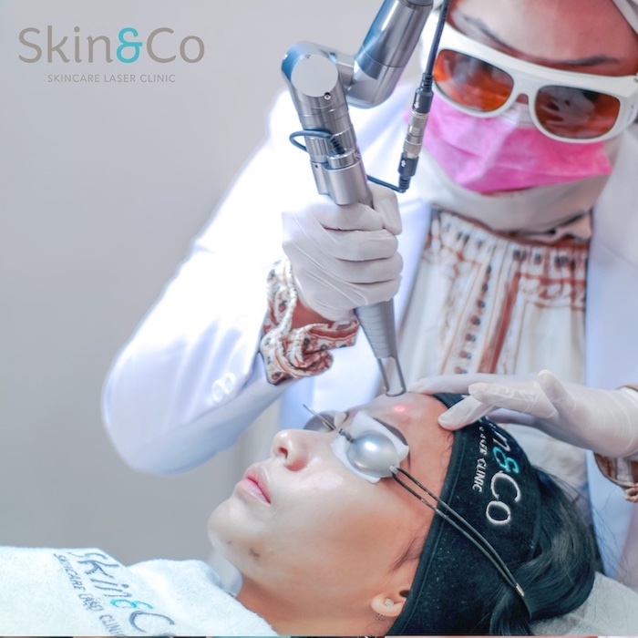 Rekomendasi Klinik Untuk Melakukan Perawatan Laser Wajah