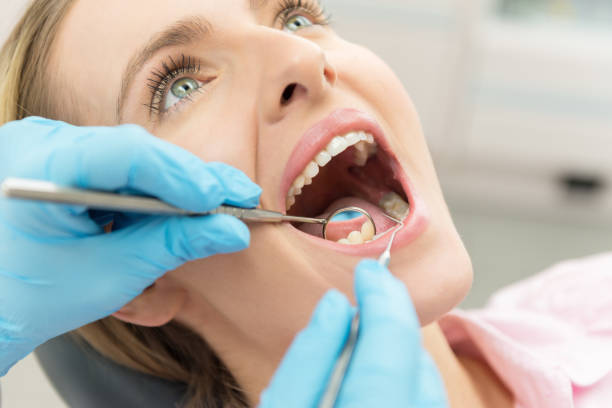 Sering Diabaikan, Ini 7 Penyebab Karang Gigi 
