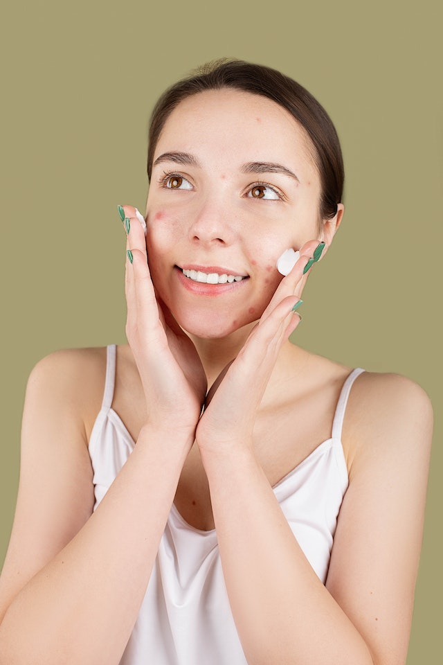 Basic Skincare untuk Kulit Berjerawat, Cukup 4 Langkah Saja!