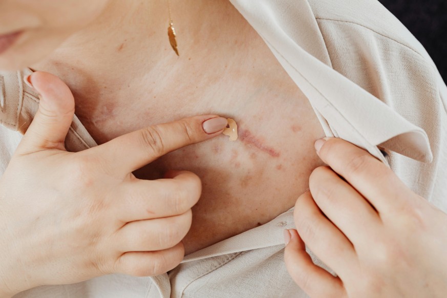Catat! Ini 4 Symptoms Alergi yang Perlu Diketahui