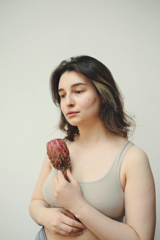 Tubuhmu Berjerawat? Ini 4 Cara Mengatasi Body Acne