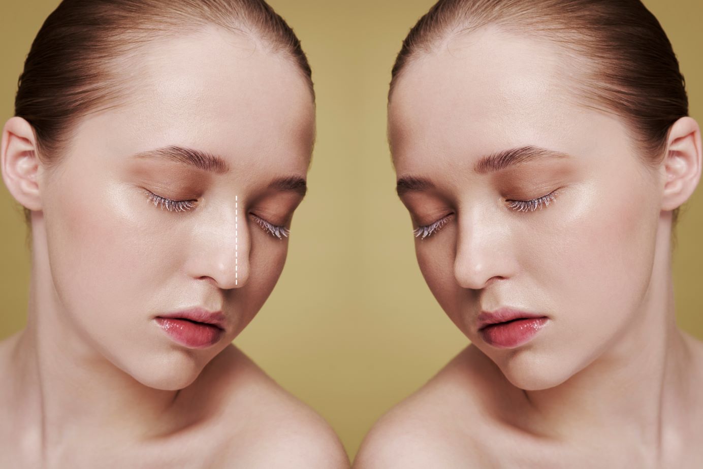 Kenali Lebih Dalam Operasi Hidung Rhinoplasty